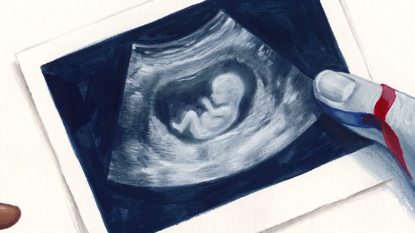 Illustration: a fingertip resting on an ultrasound print